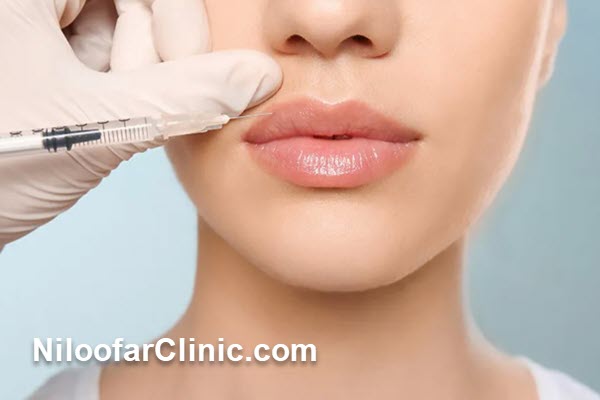 عوامل مؤثر بر قیمت تزریق ژل در گلشهر کرج چقدر است؟