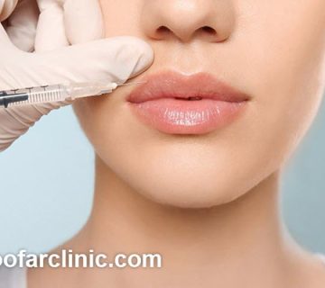 قیمت تزریق ژل در گلشهر کرج چقدر است؟