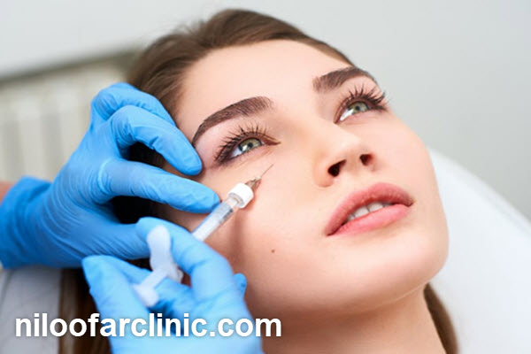 مزایای تزریق فیلر زیر چشم