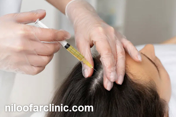 مزایای مزوتراپی مو