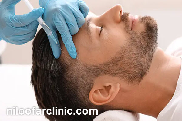 چه کسانی کاندید مناسب مزوتراپی مو هستند؟