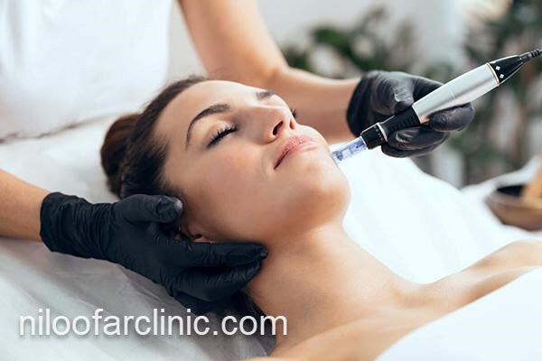 از بین بردن اسکارهای پوستی در کرج | نیلوفر کلینیک