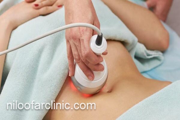تناسب اندام با دستگاه کویتیشن در استان البرز | نیلوفر کلینیک