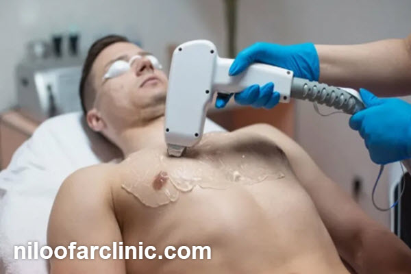 مزایای انتخاب مرکز معتبر لیزر موهای زائد
