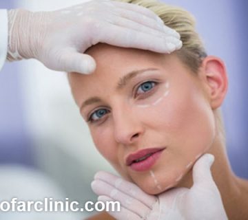 بهترین دکتر زاویه سازی صورت در کرج