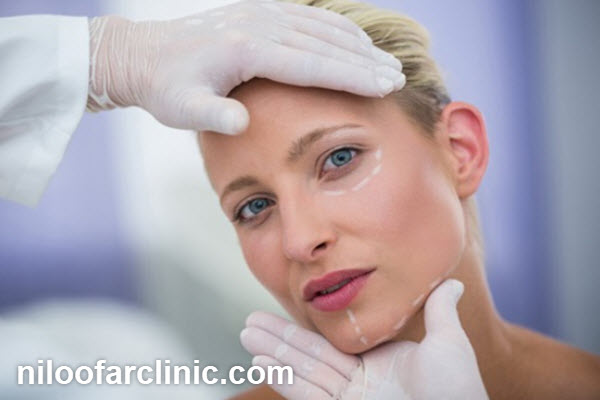 بهترین دکتر زاویه سازی صورت در کرج