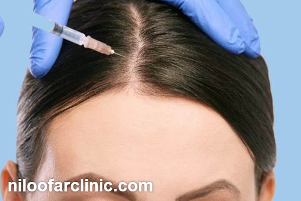 چالش های مزوتراپی مو