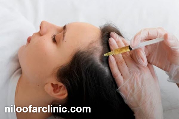 اهمیت انتخاب بهترین کلینیک مزوتراپی مو در مهرویلا کرج