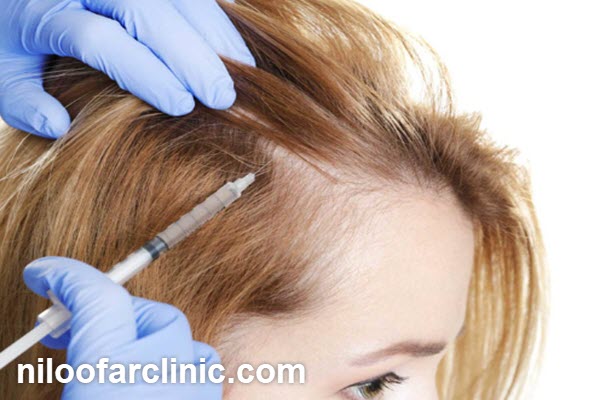 بهترین کلینیک مزوتراپی مو در مهرویلا کرج