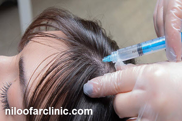 بهترین کلینیک مزوتراپی مو در کرج