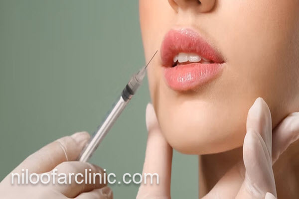 تزریق ژل توسط پزشک مجرب | کلینیک نیلوفر