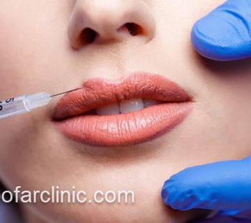 بهترین مرکز تزریق ژل در کرج | کلینیک نیلوفر