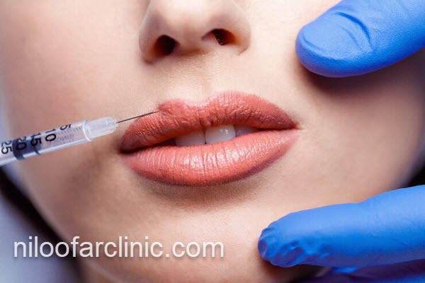بهترین مرکز تزریق ژل در کرج | کلینیک نیلوفر