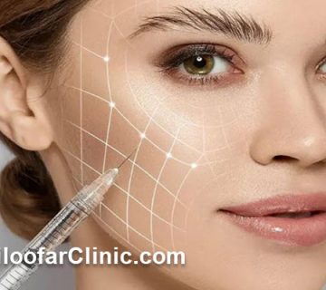 بهترین دکتر تزریق فیلر در کرج